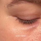 Prebiotic Skin Recharge Treatment