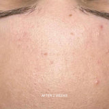 Prebiotic Skin Recharge Treatment