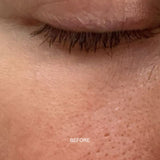 Prebiotic Skin Recharge Treatment