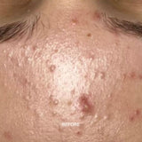 Prebiotic Skin Recharge Treatment