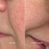 Prebiotic Skin Recharge Treatment